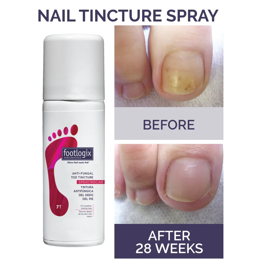 FOOTLOGIX Nail tincture spray